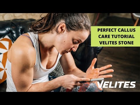 Velite's callus remover